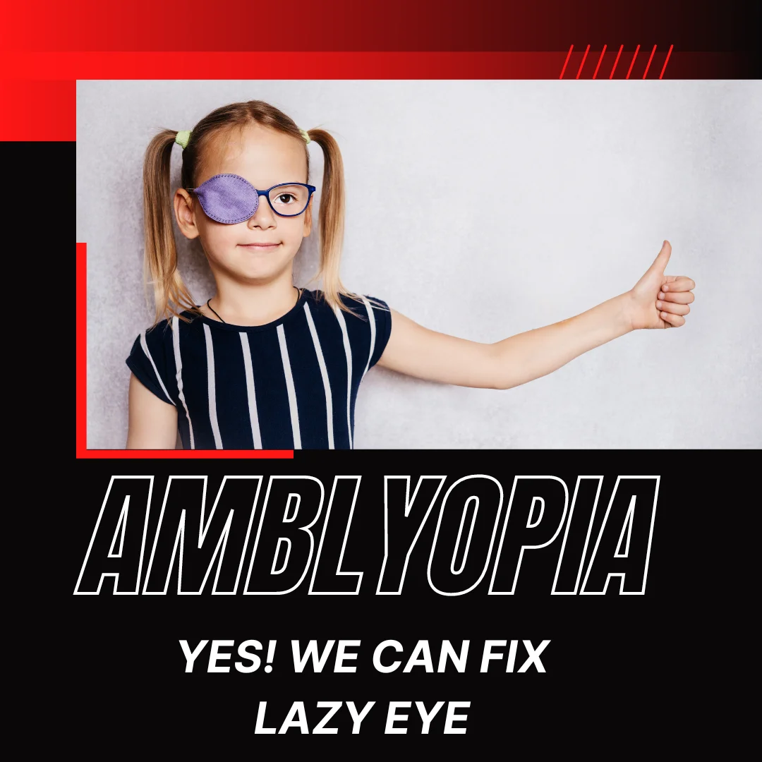 Amblyopia (Lazy Eye)